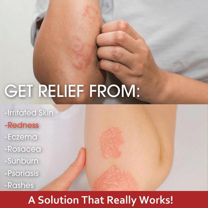 JEREMYTIS Herbal Natural 0-Stimulation Soothing Cream